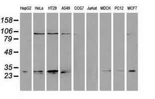 NNMT Antibody - Western blot of extracts (35 ug) from 9 different cell lines by using anti-NNMT monoclonal antibody.