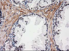 NNMT Antibody - IHC of paraffin-embedded Human prostate tissue using anti-NNMT mouse monoclonal antibody.