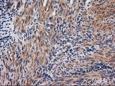 NNMT Antibody - IHC of paraffin-embedded Human endometrium tissue using anti-NNMT mouse monoclonal antibody.