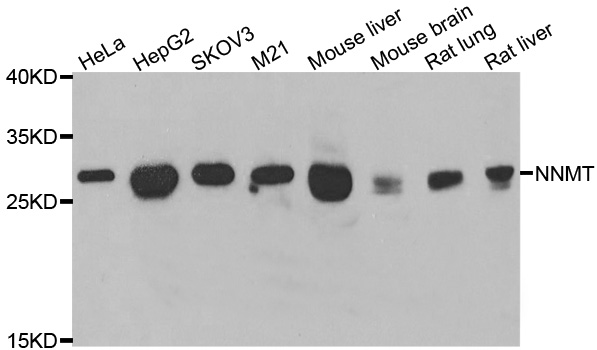 NNMT Antibody - Western blot analysis of extracts of various cell lines.