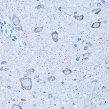 NNMT Antibody - Immunohistochemistry of paraffin-embedded mouse spinal cord tissue.