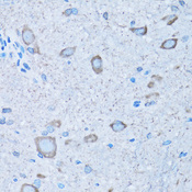 NNMT Antibody - Immunohistochemistry of paraffin-embedded mouse spinal cord tissue.