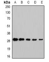 NNMT Antibody - Western blot analysis of NNMT expression in HeLa (A); HepG2 (B); mouse brain (C); rat lung (D); rat liver (E) whole cell lysates.