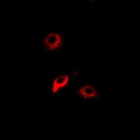NNMT Antibody - Immunofluorescent analysis of NNMT staining in HeLa cells. Formalin-fixed cells were permeabilized with 0.1% Triton X-100 in TBS for 5-10 minutes and blocked with 3% BSA-PBS for 30 minutes at room temperature. Cells were probed with the primary antibody in 3% BSA-PBS and incubated overnight at 4 deg C in a humidified chamber. Cells were washed with PBST and incubated with a DyLight 594-conjugated secondary antibody (red) in PBS at room temperature in the dark.