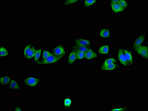 NNMT Antibody - Immunofluorescent analysis of HepG2 cells using NNMT Antibody at a dilution of 1:100 and Alexa Fluor 488-congugated AffiniPure Goat Anti-Rabbit IgG(H+L)