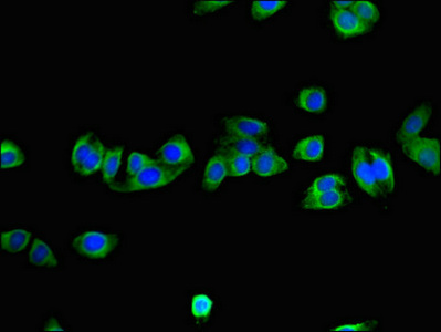 NNMT Antibody - Immunofluorescent analysis of HepG2 cells using NNMT Antibody at dilution of 1:100 and Alexa Fluor 488-congugated AffiniPure Goat Anti-Rabbit IgG(H+L)