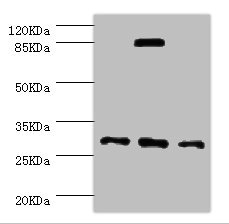 NNMT Antibody - Western blot All Lanes:NNMT antibody at 2.47ug/ml Lane 1:HepG2 whole cell lysate Lane 2:Hela whole cell lysate Lane 3:A549 whole cell lysate Secondary Goat polyclonal to rabbit at 1/10000 dilution Predicted band size: 30kDa Observed band size: 30kDa,80kDa (We are unsure as to the identity of this extra band)