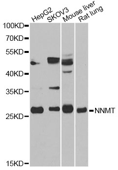 NNMT Antibody - Western blot analysis of extracts of various cell lines, using NNMT antibody at 1:1000 dilution. The secondary antibody used was an HRP Goat Anti-Rabbit IgG (H+L) at 1:10000 dilution. Lysates were loaded 25ug per lane and 3% nonfat dry milk in TBST was used for blocking. An ECL Kit was used for detection and the exposure time was 10s.