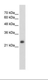 NNMT Antibody - HepG2 Cell Lysate.  This image was taken for the unconjugated form of this product. Other forms have not been tested.