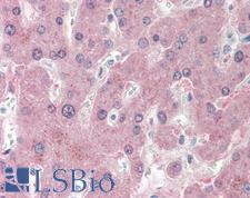 NNMT Antibody - Anti-NNMT antibody IHC staining of human liver. Immunohistochemistry of formalin-fixed, paraffin-embedded tissue after heat-induced antigen retrieval. Antibody concentration 20 ug/ml. This image was taken for the unconjugated form of this product. Other forms have not been tested.