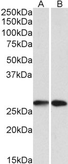 NNMT Antibody - Antibody (0.1µg/ml) staining of A549 (A) and HeLA (B) lysates (35µg protein in RIPA buffer). Primary incubation was 1 hour. Detected by chemiluminescence.