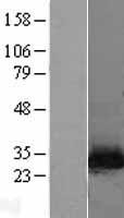 NNMT Protein - Western validation with an anti-DDK antibody * L: Control HEK293 lysate R: Over-expression lysate
