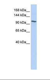 NNT Antibody - Fetal liver lysate. Antibody concentration: 1.0 ug/ml. Gel concentration: 6-18%.  This image was taken for the unconjugated form of this product. Other forms have not been tested.