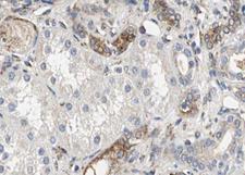 NNT Antibody - 1:100 staining human kidney tissue by IHC-P. The sample was formaldehyde fixed and a heat mediated antigen retrieval step in citrate buffer was performed. The sample was then blocked and incubated with the antibody for 1.5 hours at 22°C. An HRP conjugated goat anti-rabbit antibody was used as the secondary.