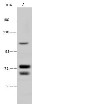 NNT Antibody - Anti-NNT rabbit polyclonal antibody at 1:500 dilution. Lane A: NIH-3T3 Whole Cell Lysate. Lysates/proteins at 30 ug per lane. Secondary: Goat Anti-Rabbit IgG (H+L)/HRP at 1/10000 dilution. Developed using the ECL technique. Performed under reducing conditions. Predicted band size: 114 kDa.