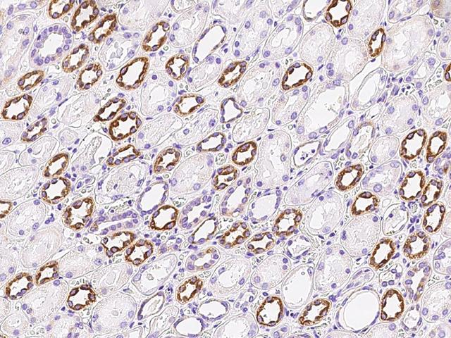 NNT Antibody - Immunochemical staining of human NNT in human kidney with rabbit polyclonal antibody at 1:5000 dilution, formalin-fixed paraffin embedded sections.