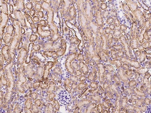 NNT Antibody - Immunochemical staining of human NNT in mouse kidney with rabbit polyclonal antibody at 1:5000 dilution, formalin-fixed paraffin embedded sections.