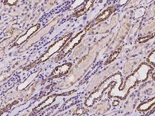 NNT Antibody - Immunochemical staining of human NNT in human kidney with rabbit polyclonal antibody at 1:100 dilution, formalin-fixed paraffin embedded sections.