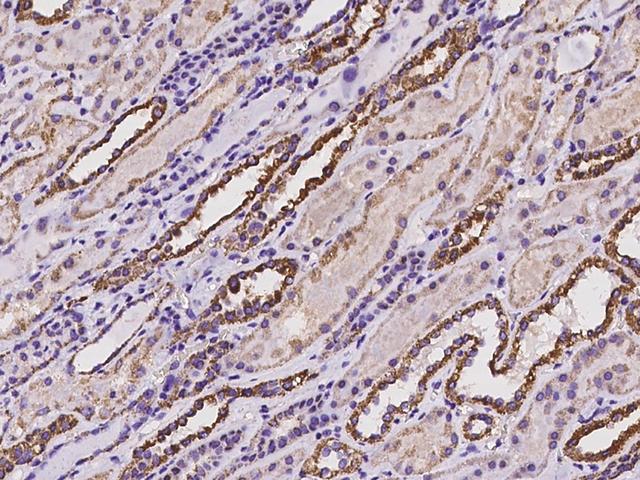 NNT Antibody - Immunochemical staining of human NNT in human kidney with rabbit polyclonal antibody at 1:100 dilution, formalin-fixed paraffin embedded sections.