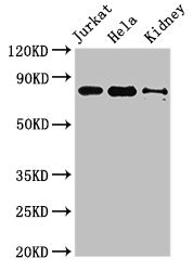 NOA1 / C4orf14 Antibody - Western Blot Positive WB detected in:Jurkat whole cell lysate,Hela whole cell lysate,Mouse kidney tissue All Lanes:NOA1 antibody at 3.4µg/ml Secondary Goat polyclonal to rabbit IgG at 1/50000 dilution Predicted band size: 79 KDa Observed band size: 79 KDa