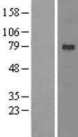 NOA1 / C4orf14 Protein - Western validation with an anti-DDK antibody * L: Control HEK293 lysate R: Over-expression lysate