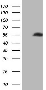 NOB1 / NOB1P Antibody - HEK293T cells were transfected with the pCMV6-ENTRY control. (Left lane) or pCMV6-ENTRY NOB1. (Right lane) cDNA for 48 hrs and lysed. Equivalent amounts of cell lysates. (5 ug per lane) were separated by SDS-PAGE and immunoblotted with anti-NOB1. (1:2000)