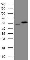 NOB1 / NOB1P Antibody - HEK293T cells were transfected with the pCMV6-ENTRY control. (Left lane) or pCMV6-ENTRY NOB1. (Right lane) cDNA for 48 hrs and lysed. Equivalent amounts of cell lysates. (5 ug per lane) were separated by SDS-PAGE and immunoblotted with anti-NOB1. (1:2000)