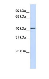 NOB1 / NOB1P Antibody - Fetal liver lysate. Antibody concentration: 1.0 ug/ml. Gel concentration: 12%.  This image was taken for the unconjugated form of this product. Other forms have not been tested.