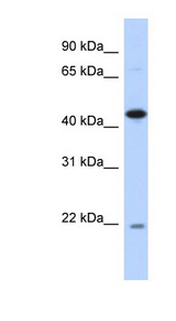NOB1 / NOB1P Antibody - NOB1 antibody Western blot of Transfected 293T cell lysate. This image was taken for the unconjugated form of this product. Other forms have not been tested.