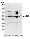 NOB1 / NOB1P Antibody - Detection of human and mouse NOB1 by western blot. Samples: Whole cell lysate (50 µg) from HeLa, HEK293T, Jurkat, mouse TCMK-1, and mouse NIH 3T3 cells prepared using NETN lysis buffer. Antibodies: Affinity purified rabbit anti-NOB1 antibody used for WB at 0.1 µg/ml. Detection: Chemiluminescence with an exposure time of 3 minutes.