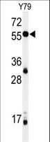 NOB1 / NOB1P Antibody - Western blot of NOB1 Antibody in Y79 cell line lysates (35 ug/lane). NOB1 (arrow) was detected using the purified antibody.