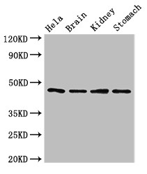 NOB1 / NOB1P Antibody - Positive WB detected in:Hela whole cell lysate,Mouse brain tissue,Mouse kidney tissue,Mouse stomach tissue;All lanes:NOB1 antibody at 1.5?g/ml;Secondary;Goat polyclonal to rabbit IgG at 1/50000 dilution;Predicted band size: 47 KDa;Observed band size: 47 KDa;