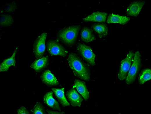 NOB1 / NOB1P Antibody - Immunofluorescent analysis of A549 cells using NOB1 Antibody at a dilution of 1:100 and Alexa Fluor 488-congugated AffiniPure Goat Anti-Rabbit IgG(H+L)