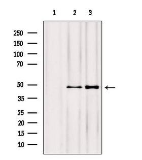 NOB1 / NOB1P Antibody - Western blot analysis of extracts of various samples using NOB1 antibody. Lane 1: HeLa treated with blocking peptide. Lane 2: HeLa; Lane 3: HepG2;