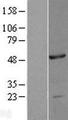 NOB1 / NOB1P Protein - Western validation with an anti-DDK antibody * L: Control HEK293 lysate R: Over-expression lysate