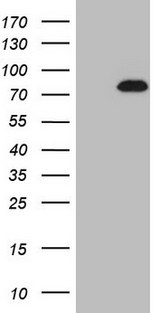 NOBOX Antibody - HEK293T cells were transfected with the pCMV6-ENTRY control. (Left lane) or pCMV6-ENTRY NOBOX. (Right lane) cDNA for 48 hrs and lysed