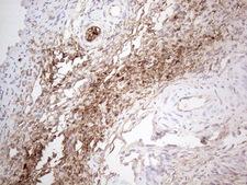NOBOX Antibody - Immunohistochemical staining of paraffin-embedded Human Ovary tissue within the normal limits using anti-NOBOX mouse monoclonal antibody. (Heat-induced epitope retrieval by 1mM EDTA in 10mM Tris buffer. (pH8.5) at 120°C for 3 min. (1:150)