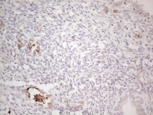 NOBOX Antibody - Immunohistochemical staining of paraffin-embedded Human endometrium tissue within the normal limits using anti-NOBOX mouse monoclonal antibody. (Heat-induced epitope retrieval by 1mM EDTA in 10mM Tris buffer. (pH8.5) at 120°C for 3 min. (1:150)