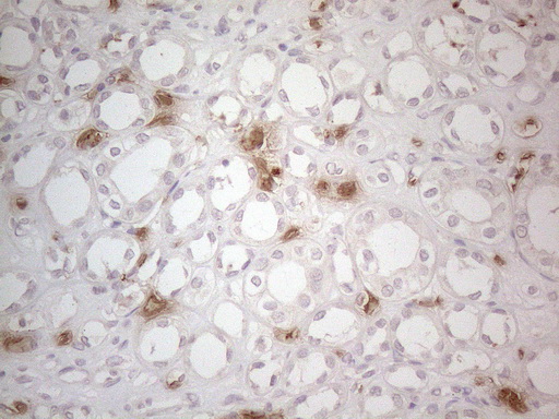 NOBOX Antibody - Immunohistochemical staining of paraffin-embedded Human Kidney tissue within the normal limits using anti-NOBOX mouse monoclonal antibody. (Heat-induced epitope retrieval by 1mM EDTA in 10mM Tris buffer. (pH8.5) at 120°C for 3 min. (1:150)