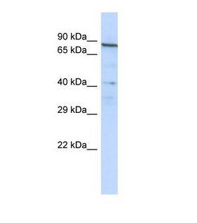 NOBOX Antibody - Western blot of Human Jurkat. NOBOX antibody dilution 1.0 ug/ml.  This image was taken for the unconjugated form of this product. Other forms have not been tested.