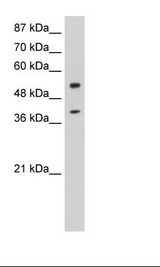 NOBOX Antibody - HepG2 Cell Lysate.  This image was taken for the unconjugated form of this product. Other forms have not been tested.
