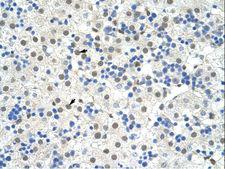 NOBOX Antibody - NOBOX antibody ARP40110_P050-XP_001134424-NOBOX (NOBOX oogenesis homeobox) Antibody was used in IHC to stain formalin-fixed, paraffin-embedded human liver.  This image was taken for the unconjugated form of this product. Other forms have not been tested.