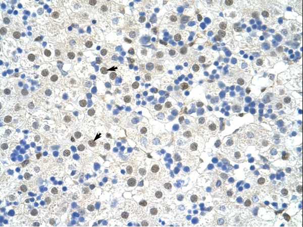 NOBOX Antibody - NOBOX antibody ARP40110_P050-XP_001134424-NOBOX (NOBOX oogenesis homeobox) Antibody was used in IHC to stain formalin-fixed, paraffin-embedded human liver.  This image was taken for the unconjugated form of this product. Other forms have not been tested.