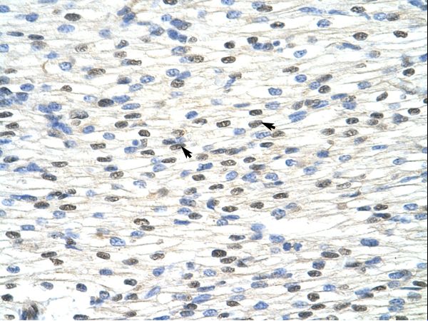 NOBOX Antibody - NOBOX antibody ARP40110_P050-XP_001134424-NOBOX (NOBOX oogenesis homeobox) Antibody was used in IHC to stain formalin-fixed, paraffin-embedded human heart.  This image was taken for the unconjugated form of this product. Other forms have not been tested.