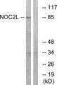 NOC2L Antibody - Western blot analysis of lysates from MCF-7 cells, using NOC2L Antibody. The lane on the right is blocked with the synthesized peptide.