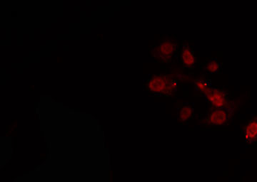 NOC2L Antibody - Staining MCF-7 cells by IF/ICC. The samples were fixed with PFA and permeabilized in 0.1% Triton X-100, then blocked in 10% serum for 45 min at 25°C. The primary antibody was diluted at 1:200 and incubated with the sample for 1 hour at 37°C. An Alexa Fluor 594 conjugated goat anti-rabbit IgG (H+L) antibody, diluted at 1/600, was used as secondary antibody.
