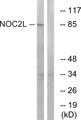 NOC2L Antibody - Western blot analysis of extracts from MCF-7 cells, using NOC2L antibody.