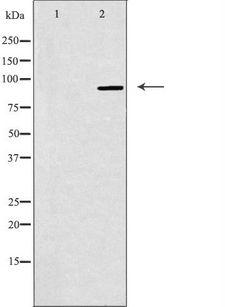 NOC3L Antibody - Western blot analysis of extracts of K562 cells using NOC3L antibody. The lane on the left is treated with the antigen-specific peptide.
