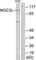 NOC3L Antibody - Western blot analysis of extracts from K562 cells, using NOC3L antibody.