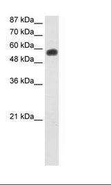 NOC4L Antibody - Jurkat Cell Lysate.  This image was taken for the unconjugated form of this product. Other forms have not been tested.